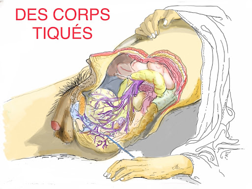 des corps tiques